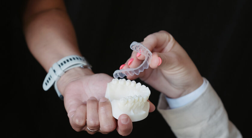 Can Dental Bridges Be Used to Replace Back Teeth?