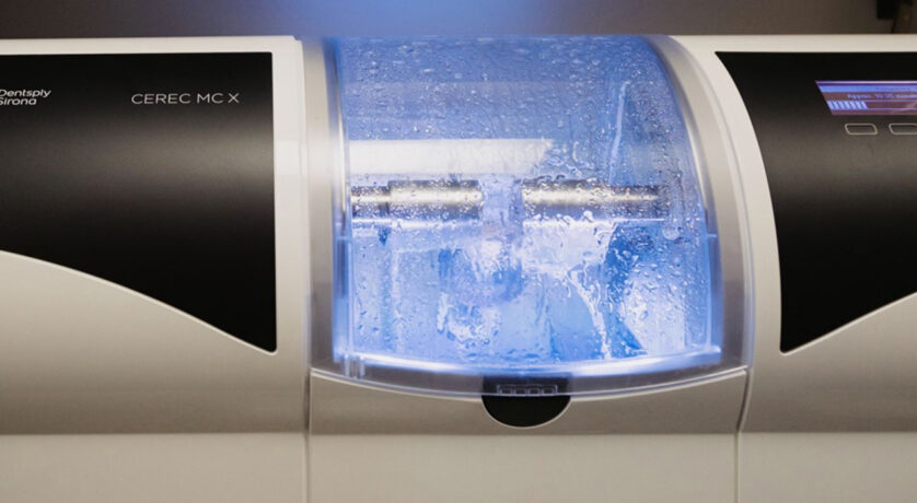 Choose Porcelain Veneers for Sparkling Smile