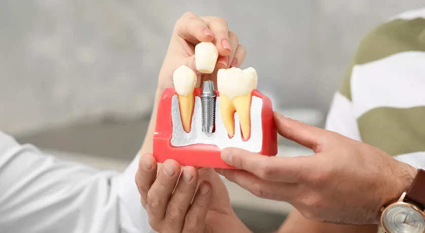 Dental implant restorations