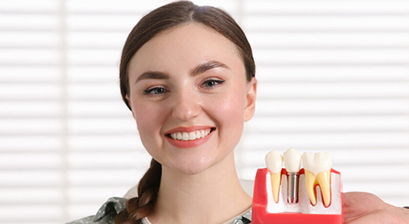 Essential Tips to Consider When Choosing an Implant Dentist