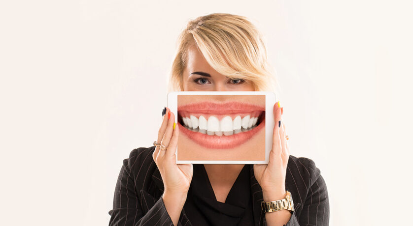 Everything You Should Know about Zoom Teeth Whitening