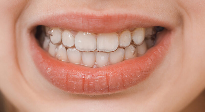 How to Stop Grinding Teeth at Night Without Night Guard?