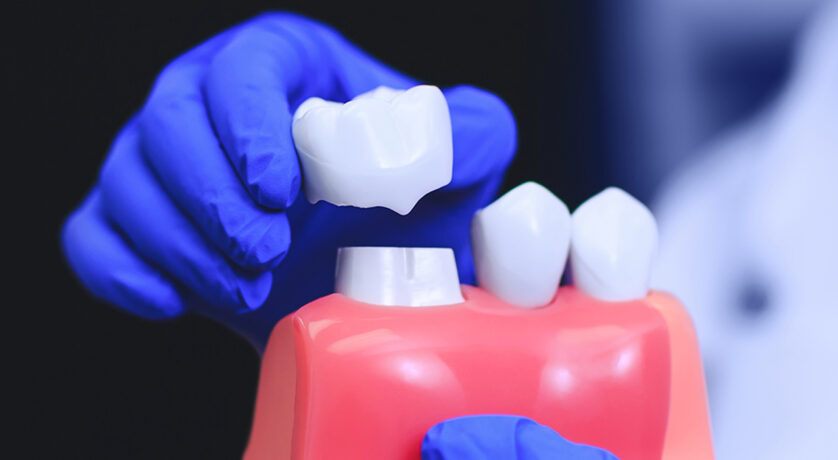 Is Getting A Dental Implant And Crown Painful?