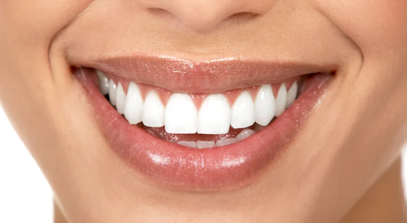 Teeth Whitening