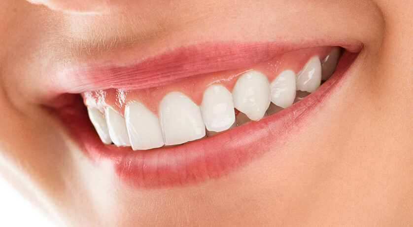 Types of Procedures Involved in Smile Makeovers in Encinitas