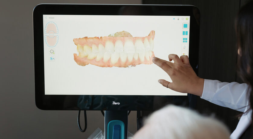 What Are the Risks of Tooth Contouring?