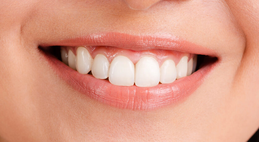 When Does Tooth Recontouring And Reshaping Become Necessary?